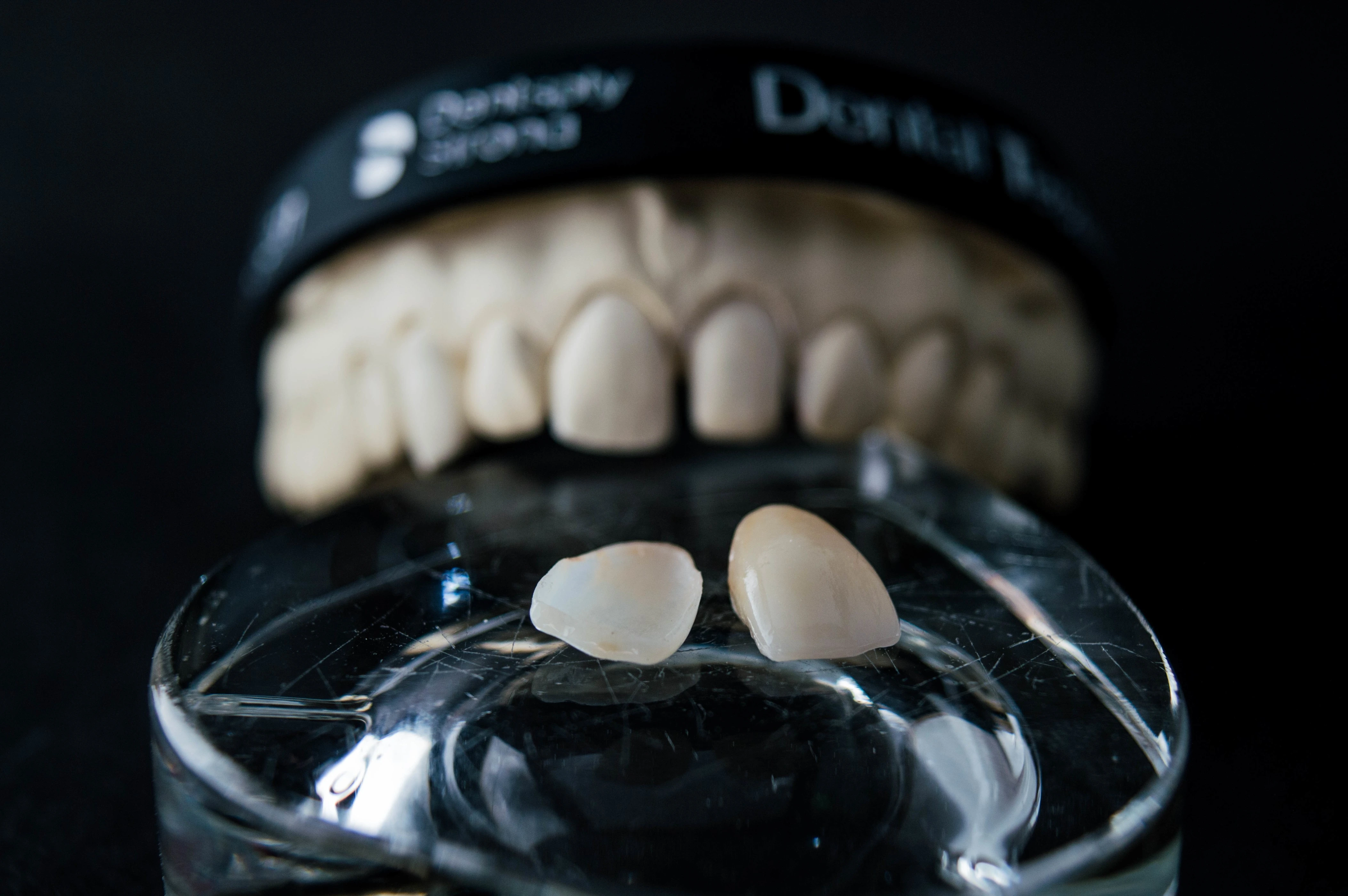 Dental Bridges